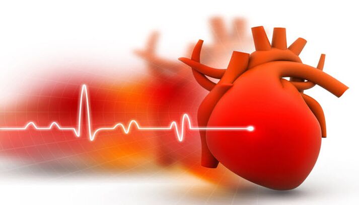 arteriālā hipertensija